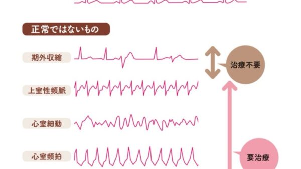 道上塾長の昔話220〜心臓の鼓動